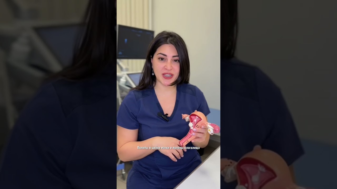 Полипы в матке причины.