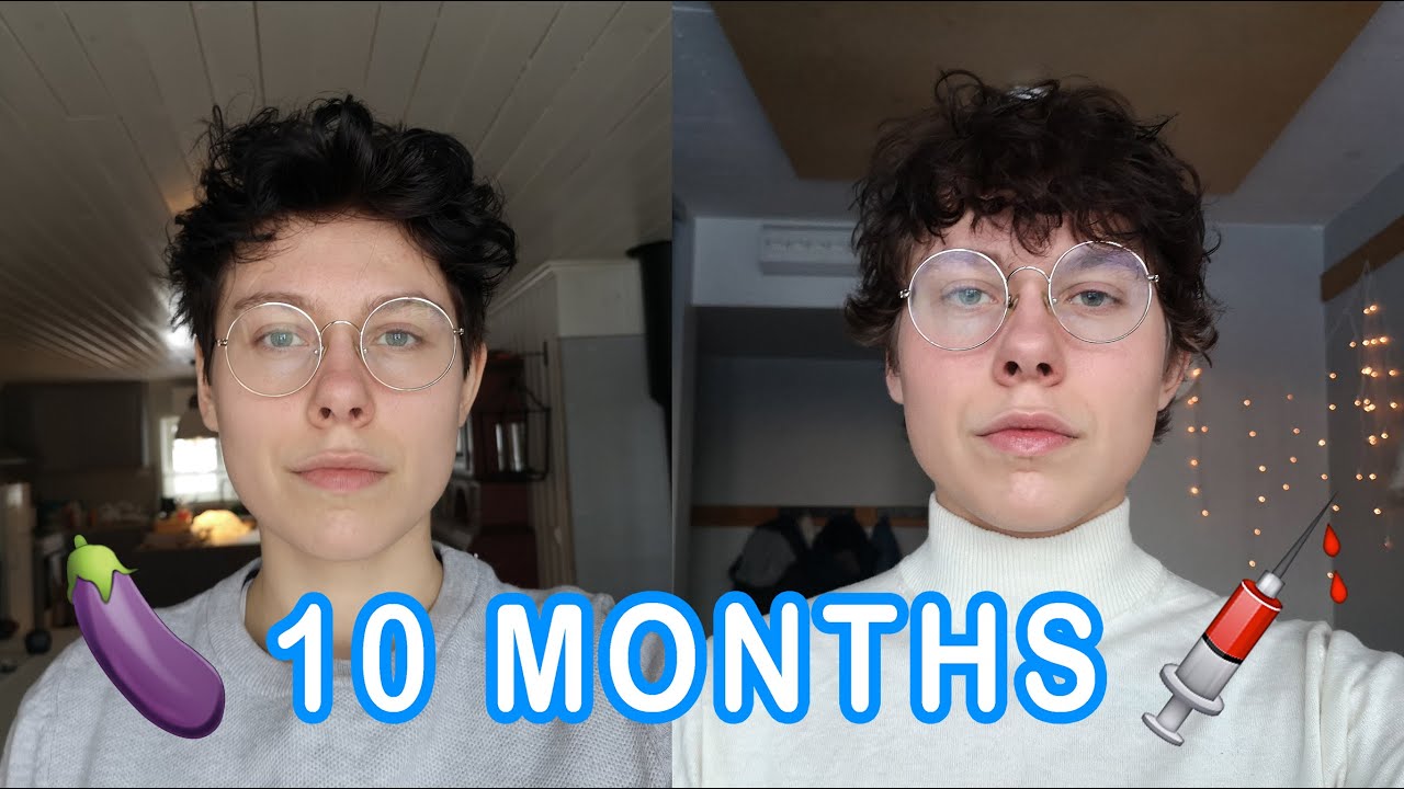 10 months on T update | FTM Trans Guy