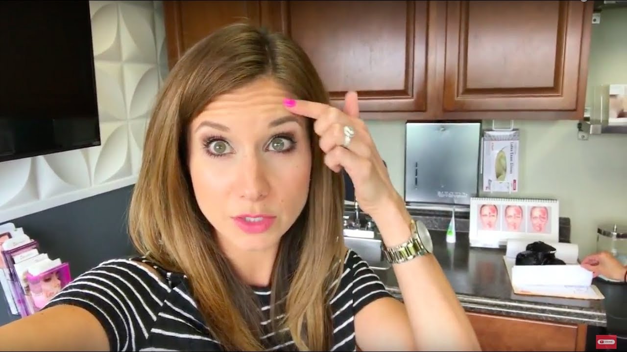 Real Talk | Botox