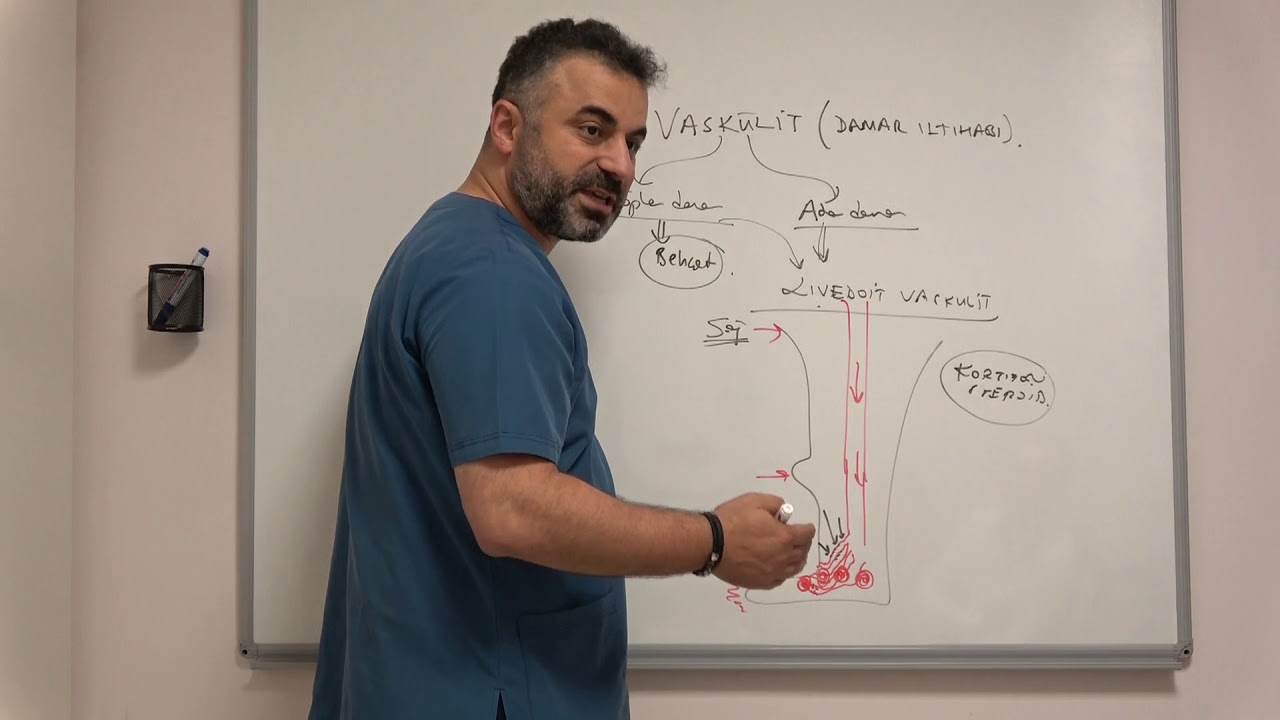 Livedoid Vaskülit (Vaskülopati) ve Vaskülit Tedavileri: Prof. Dr. Ahmet AKGUL