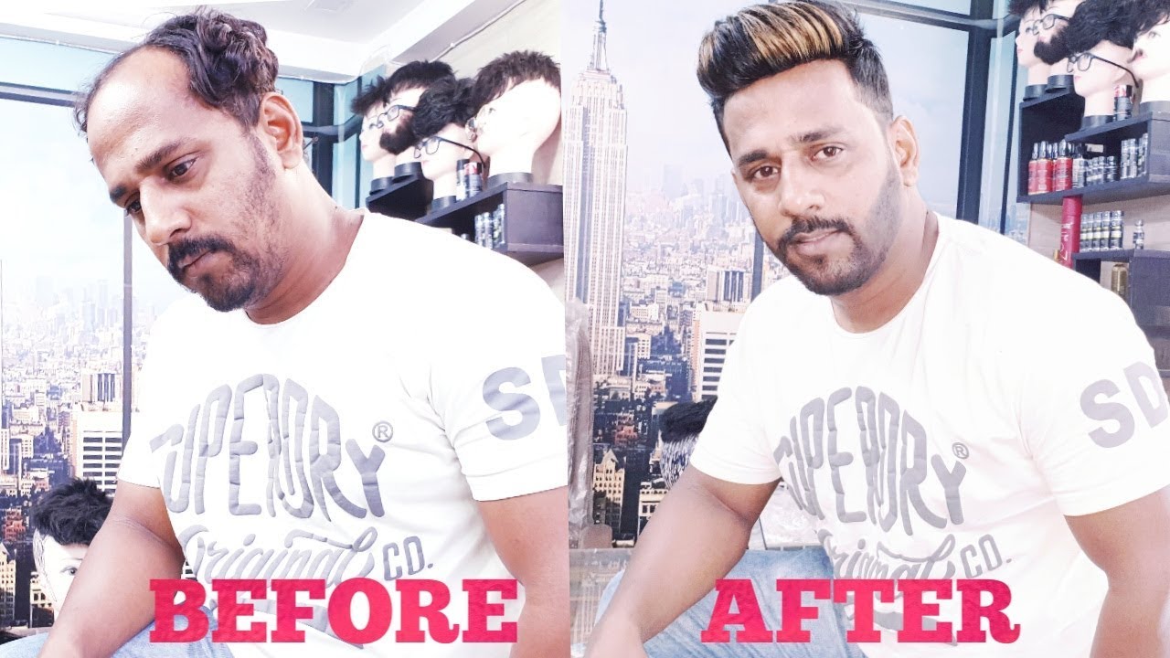 BEFORE & AFTER non surgical hair transplant stylish look by master RIZY 01142225757