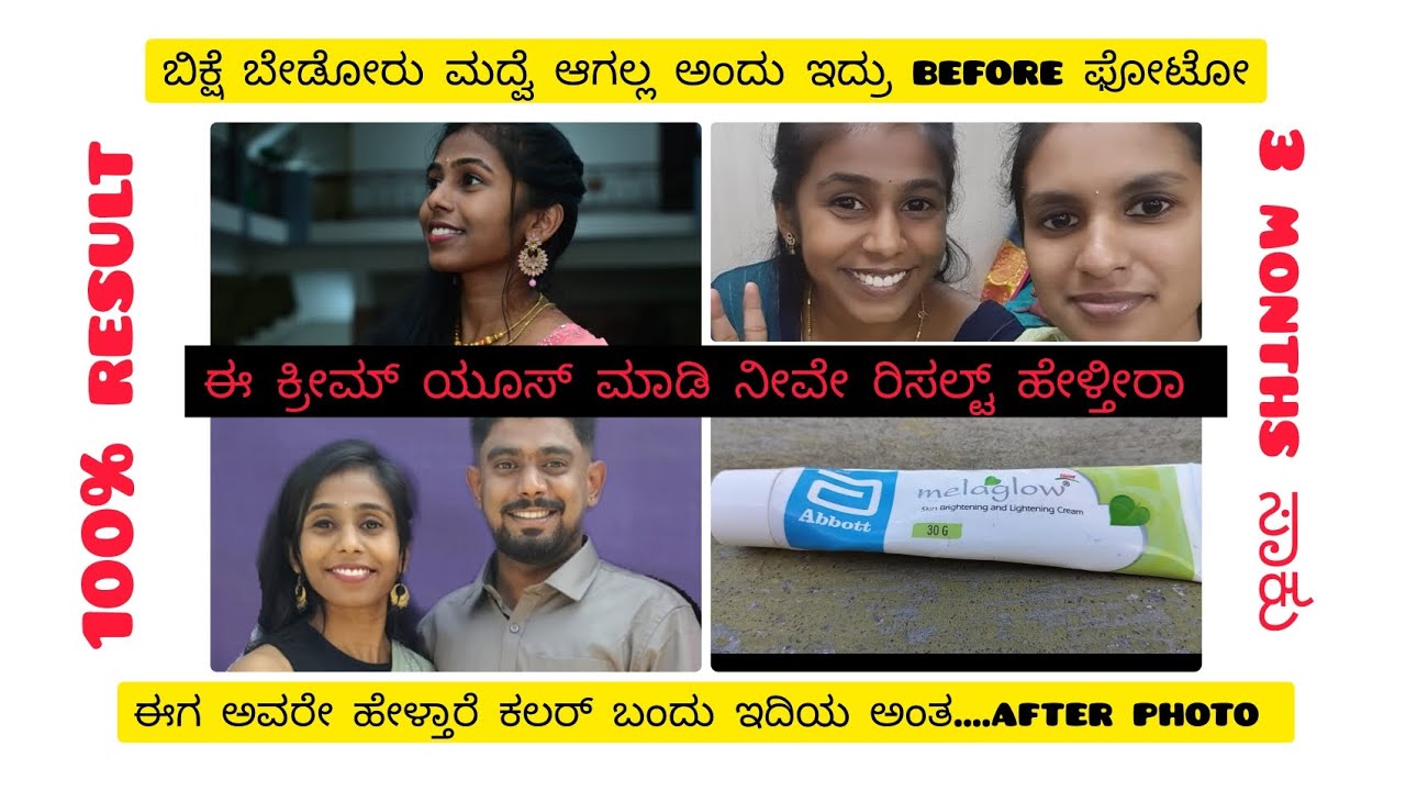 ಕಪ್ಪು ಇದ್ದೀರಾ ಅಂಥ ಯೋಚನೆ ಬೇಡ ಈ ಕ್ರೀಮ್ ಯೂಸ್ ಮಾಡಿ ನೀವೇ ರಿಸಲ್ಟ್ ನೋಡಿ //melaglow cream review// 