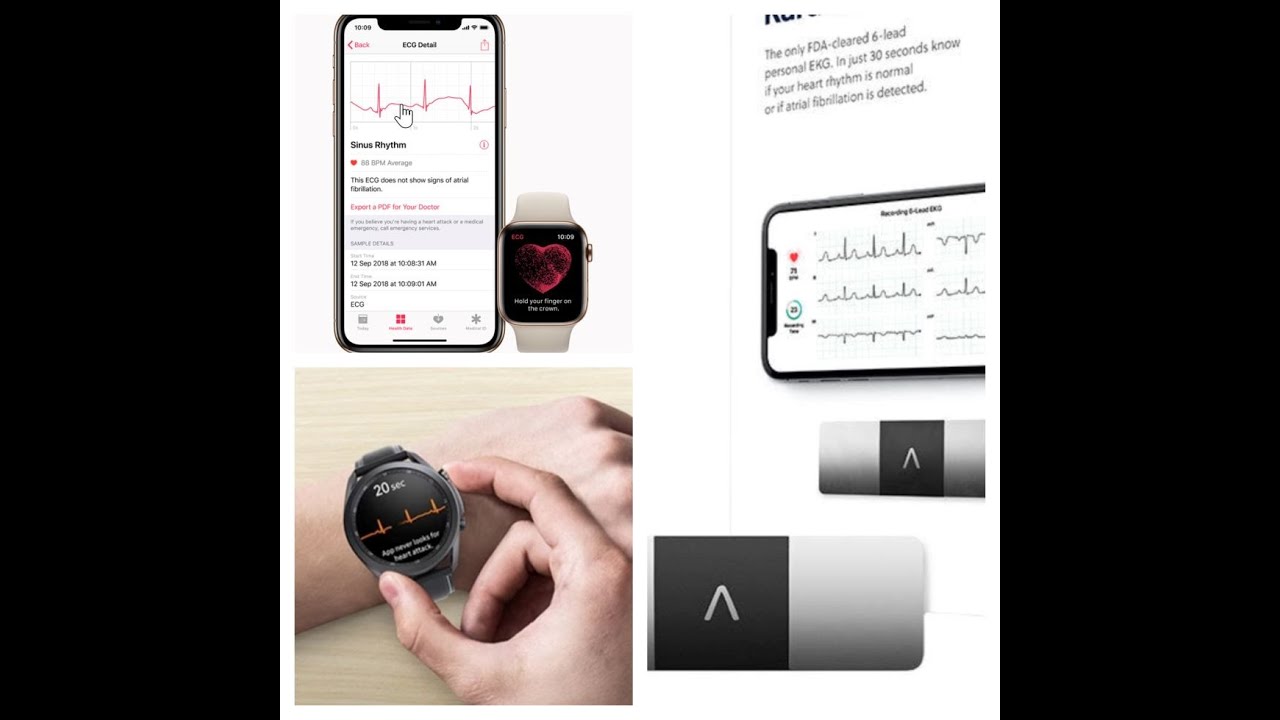 Urządzenia i zegarki z EKG - prawdy i mity. Kardia 6L, Apple, Samsung, Istel, Fitbit.