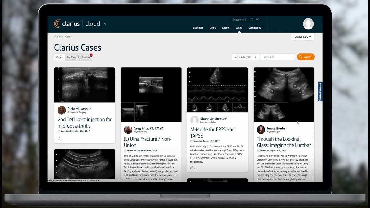 How to Use Clarius Cloud | Handheld Ultrasound Using Smartphones and Cloud | Clarius Ultrasound