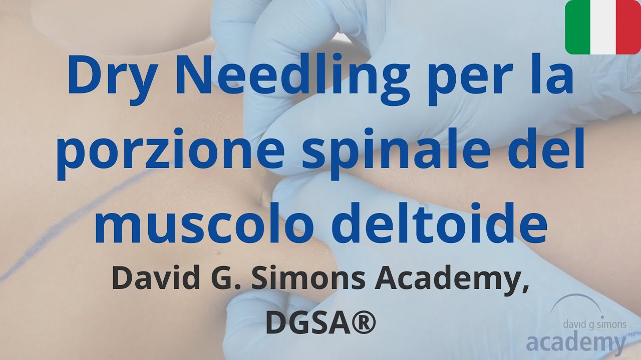 Dry Needling per la porzione spinale del muscolo deltoide