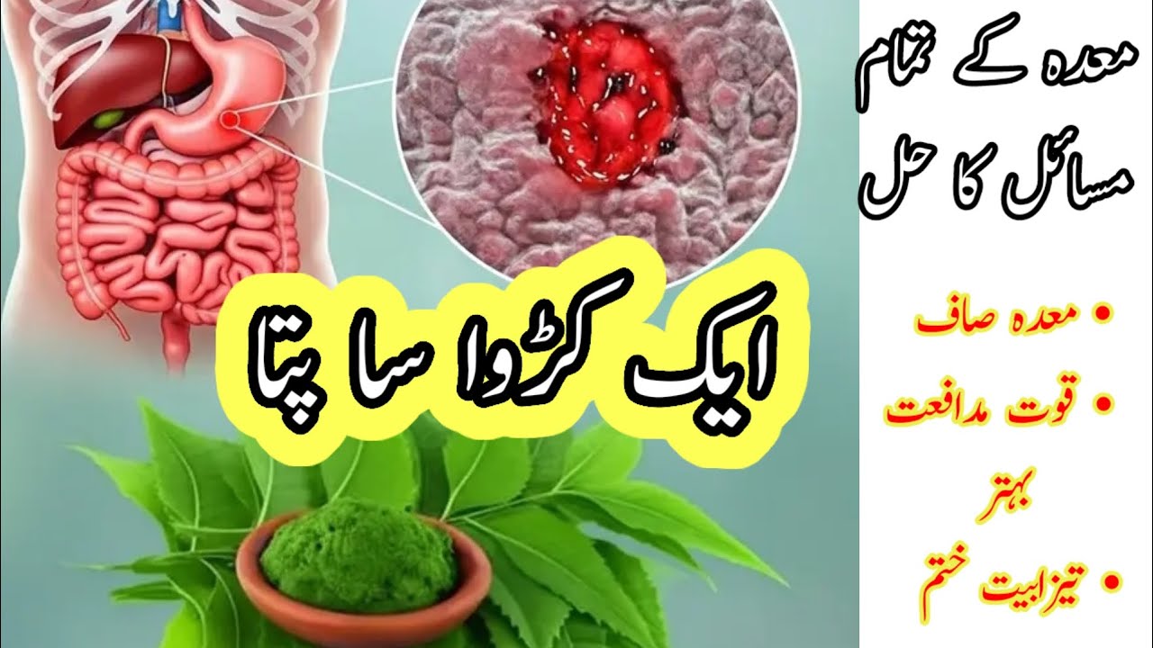 Stomach ulcer bloating acidity cure remedy with Neem Leaves | Natural Treatment for Stomach Issues