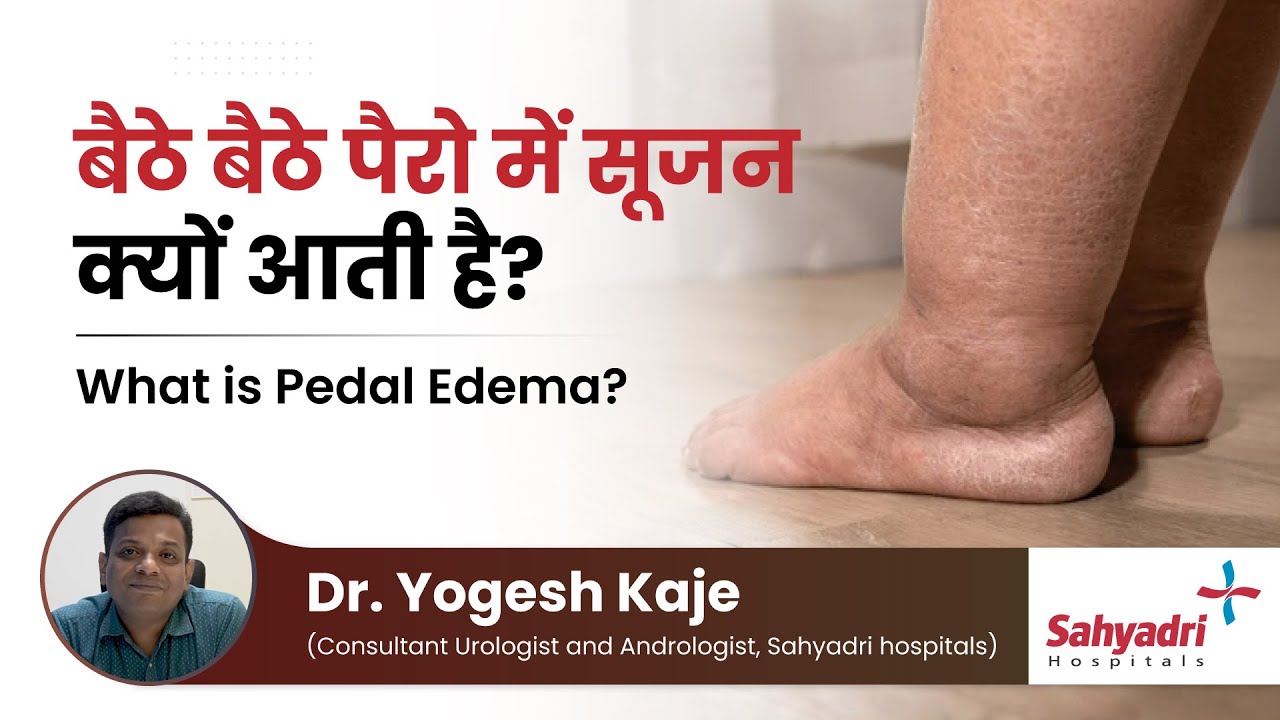 बैठे बैठे पैरो में सूजन क्यों आती है? | What is Pedal Edema? | Dr Yogesh Kaje | Sahaydri Hospital