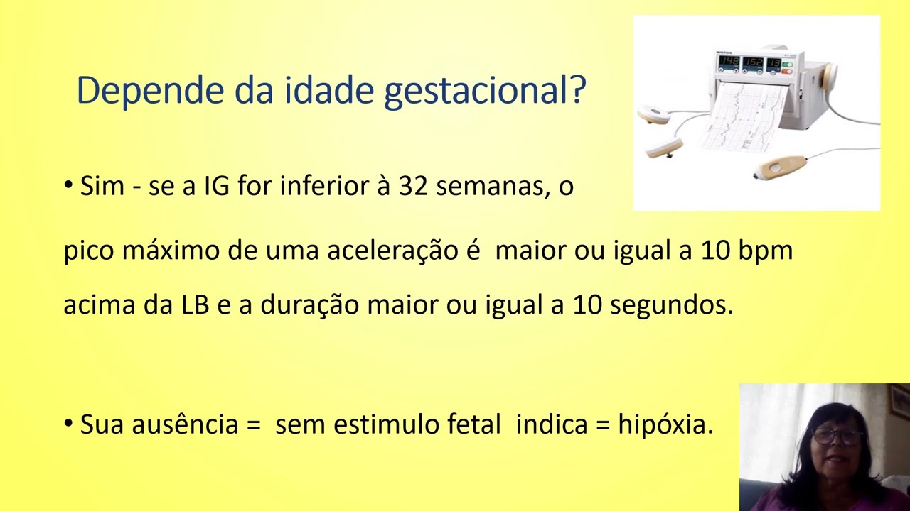 As acelerações na Cardiotocografia fetal. #cardiotocografiafetal.