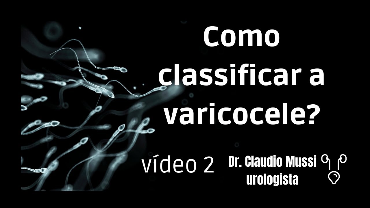 Varicocele pequena, moderada e grande