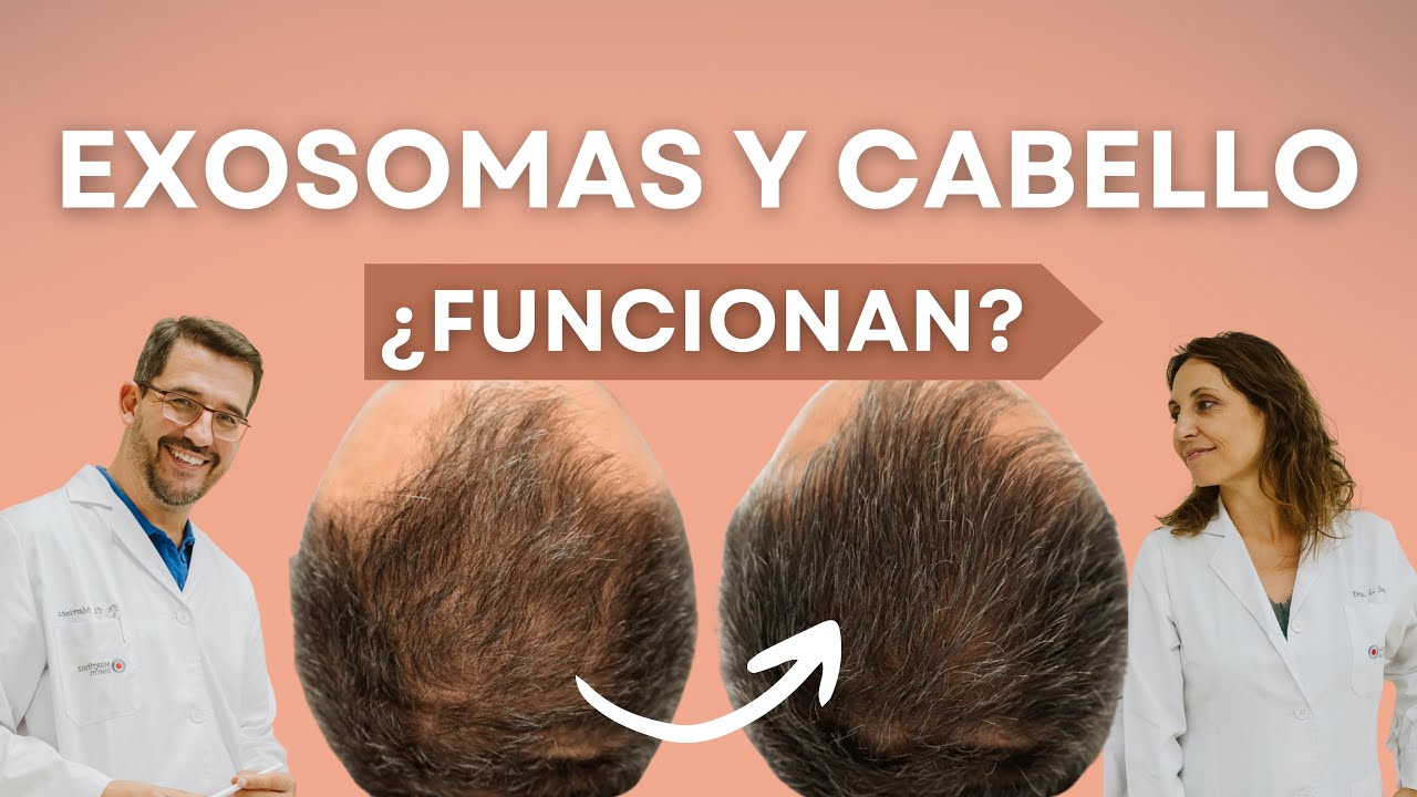 🟣 DESCUBRE cómo los EXOSOMAS afectan al Cabello y la Caída.