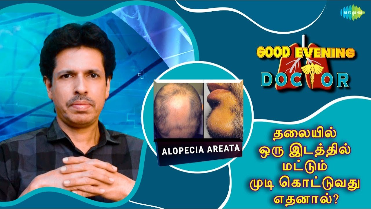 தலையில் ஒரு இடத்தில் மட்டும் முடி கொட்டுவது எதனால்? | EP 34 | Good Evening Doctor | Dr. Rajesh
