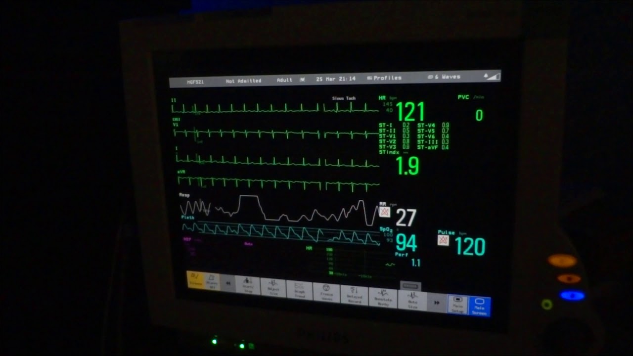 Philips IntelliVue MP70 Oxygen Desaturation Alarm