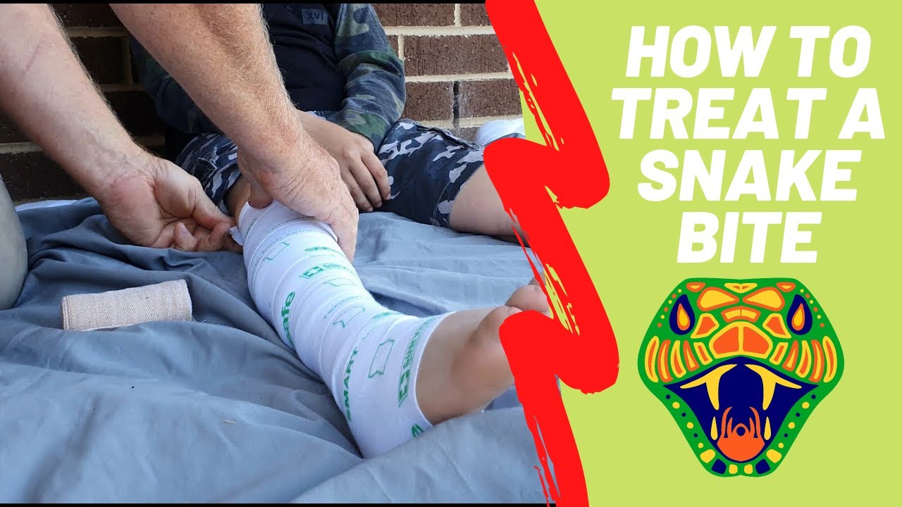 How to treat a snake bite in Australia