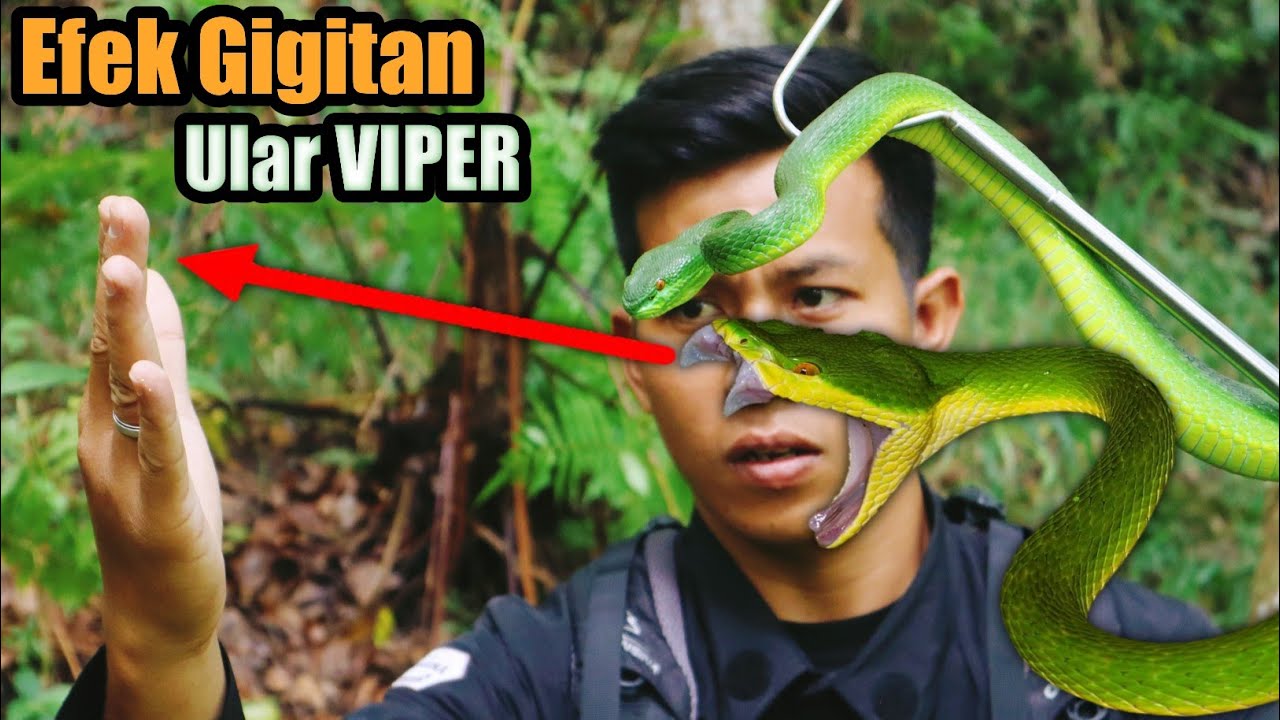EFEK GIGITAN ULAR VIPER HIJAU EKOR MERAH! SANGAT MENYAKITKAN BISA SAMPAI MENGALAMI PEMBUSUKAN!