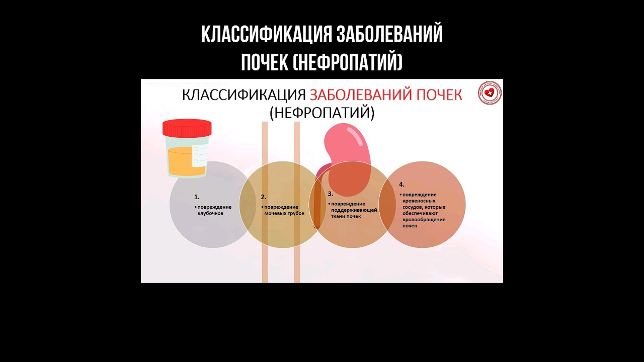 Классификация заболеваний почек (нефропатий) #почки #нефрология #нефропатия #почка
