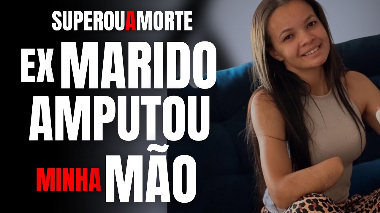 RAILMA TEVE A M&Atilde;O AMPUTADA PELO MARIDO QUE LHE DEU DIVERSAS FACADAS - ELA MESMA CONTA SUA HIST&Oacute;RIA