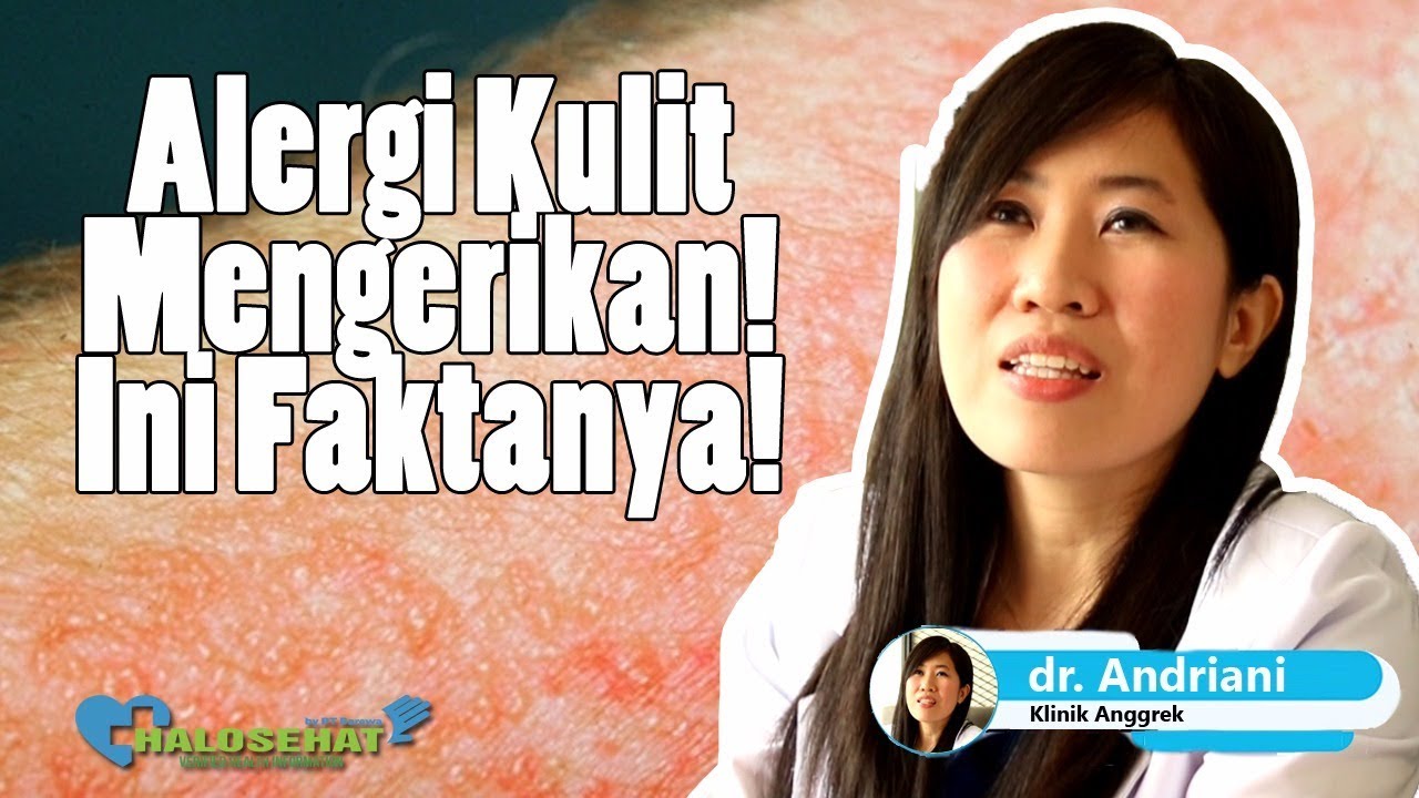 Alergi Kulit - Penyebab dan Cara Mengatasinya Secara Medis dr. Andriyani