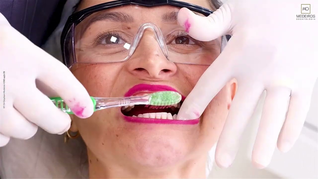 Como escovar os dentes corretamente?  veja A melhor técnica