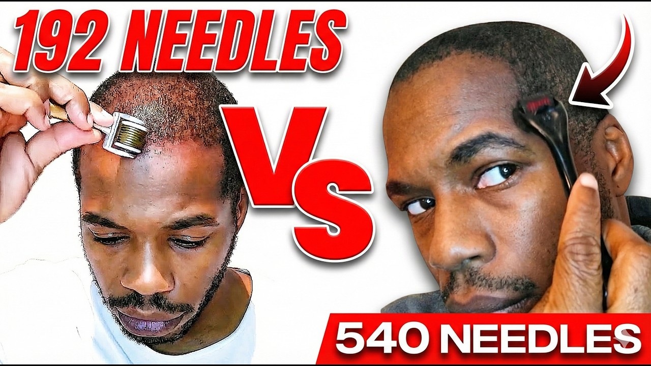 192 Needle OR 540 Needle Derma Roller