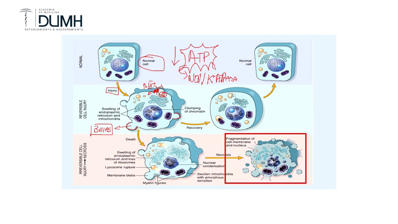 MUERTE CELULAR I APOPTOSIS Y NECROSIS