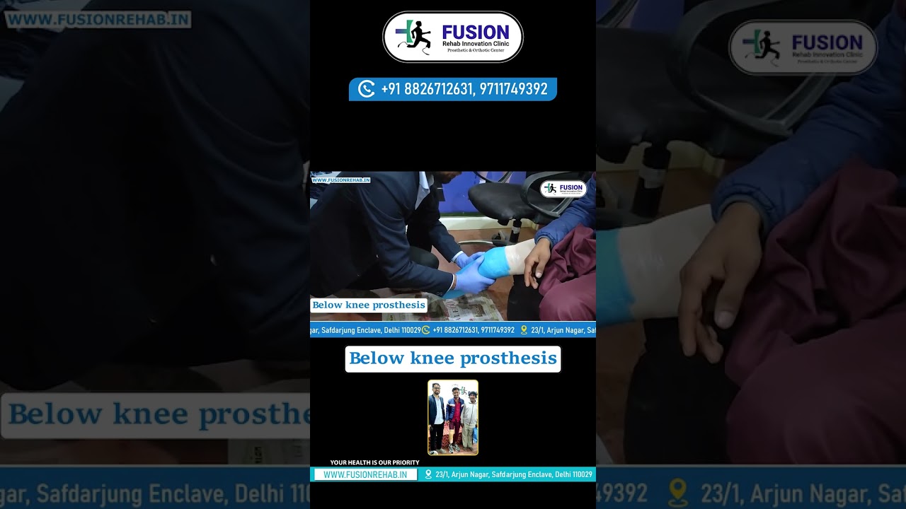 Prosthesis Orthoprosthesis // Artificial Leg // Hip Disarticulation And Aboveknee Prosthesis
