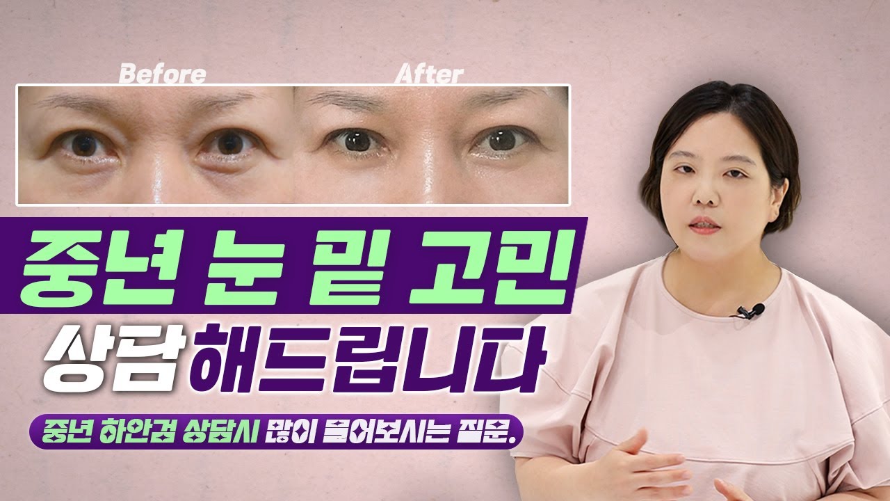 닥터혜자 피셜 📢 중년 눈밑성형 수술 고객의 공통점!