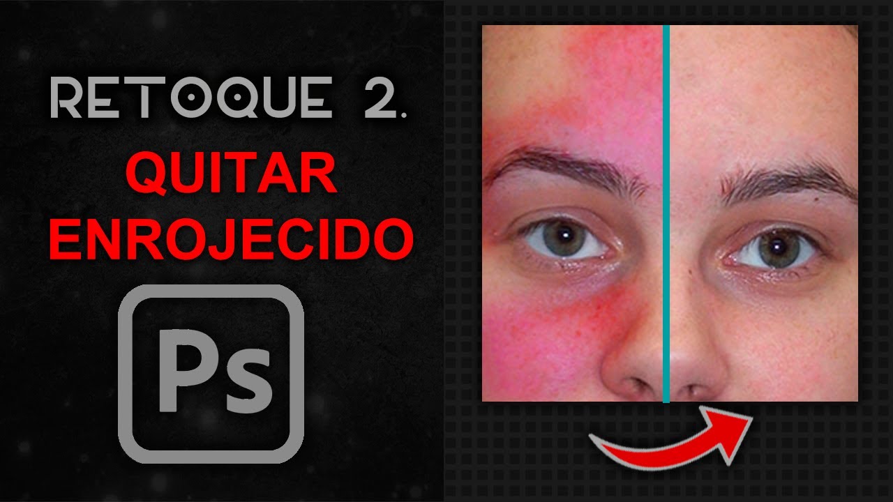 QUITA el ENROJECIMIENTO de una foto – RETOQUE DIGITAL 2 | Adobe Photoshop