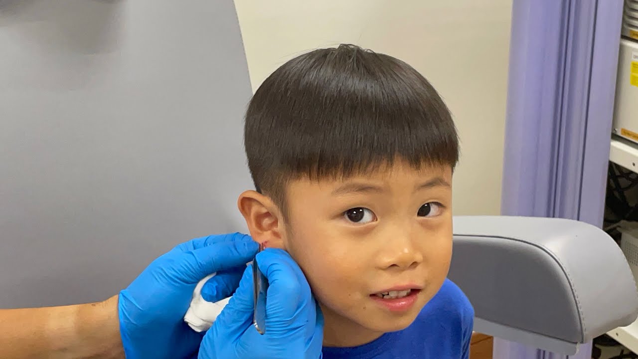 Time for Superman Casper to Remove his Stitches! 🪡