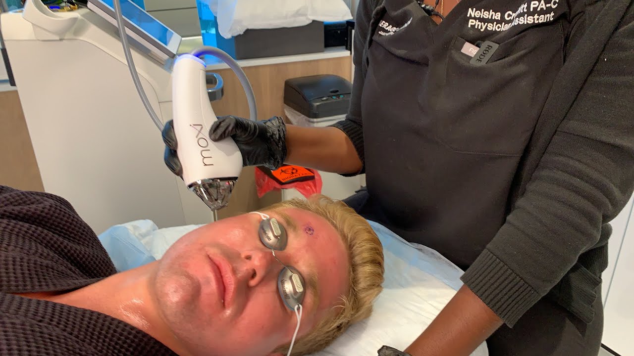 HOLLYWOOD SPOTLIGHT TREATMENT: SCITON MOXI LASER IMPROVS THE SKIN TEXTURE AND TONE | DR JASON EMER