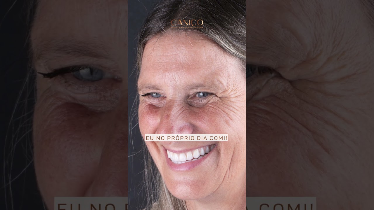 Implantes Dentários | Transforme o seu sorriso