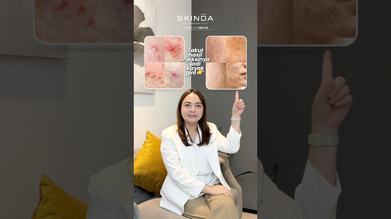 Skinda Beauties, suntik jerawat memang bisa bikin bopeng, KALAU&hellip;🫣#aesthetictreatment #acnescars