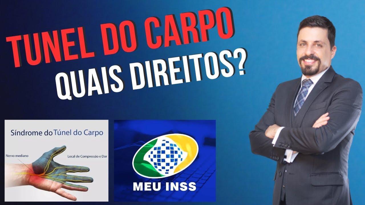 Direitos de quem tem síndrome do TUNEL DO CARPO - INSS
