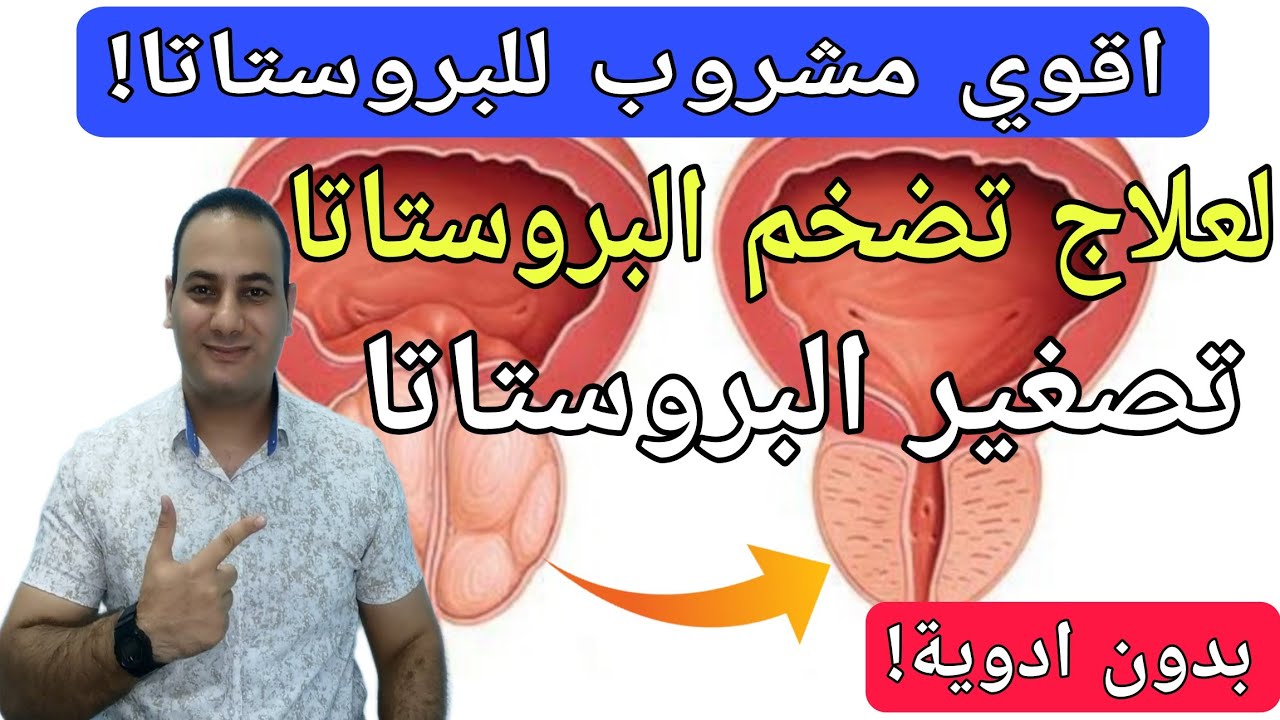 أقوى مشروب لتضخم البروستاتا الحميد لتصغير البروستاتا /علاج تضخم البروستاتا وتكرار التبول