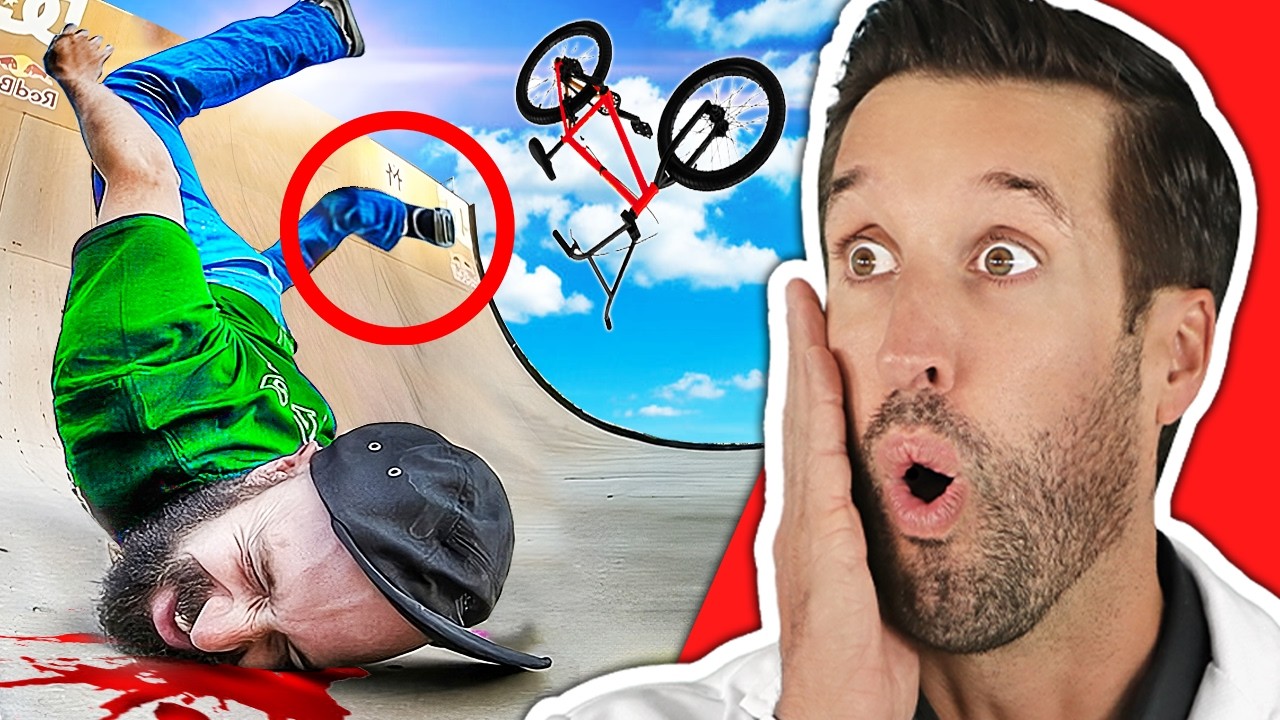ВРАЧ смотрит на самые БОЛЕЗНЕННЫЕ неудачи на BMX велосипеде
