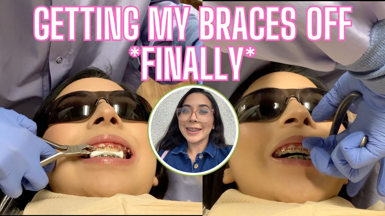 GETTING MY BRACES OFF *finally* after 3 years!