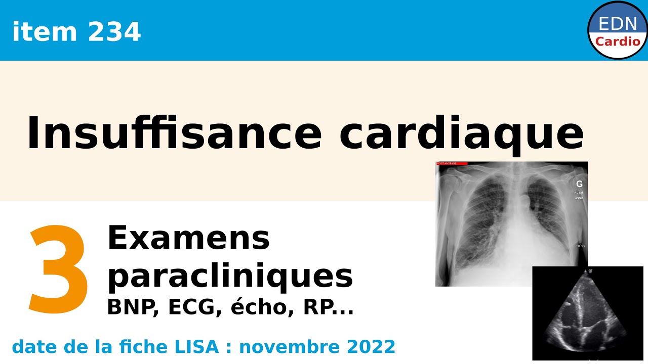 234 - Insuffisance cardiaque - Partie 3 - Examens paracliniques