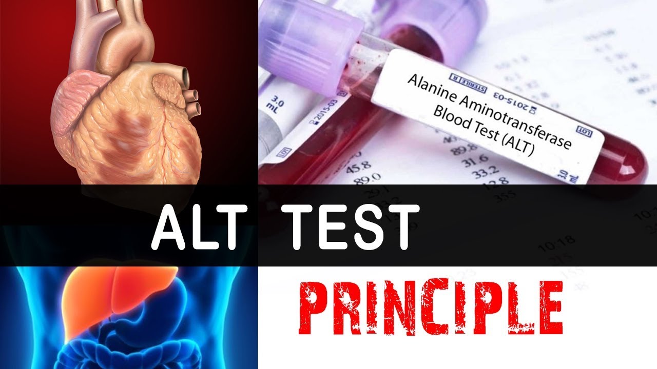 ALT Test Principle  ( Clear Explain )