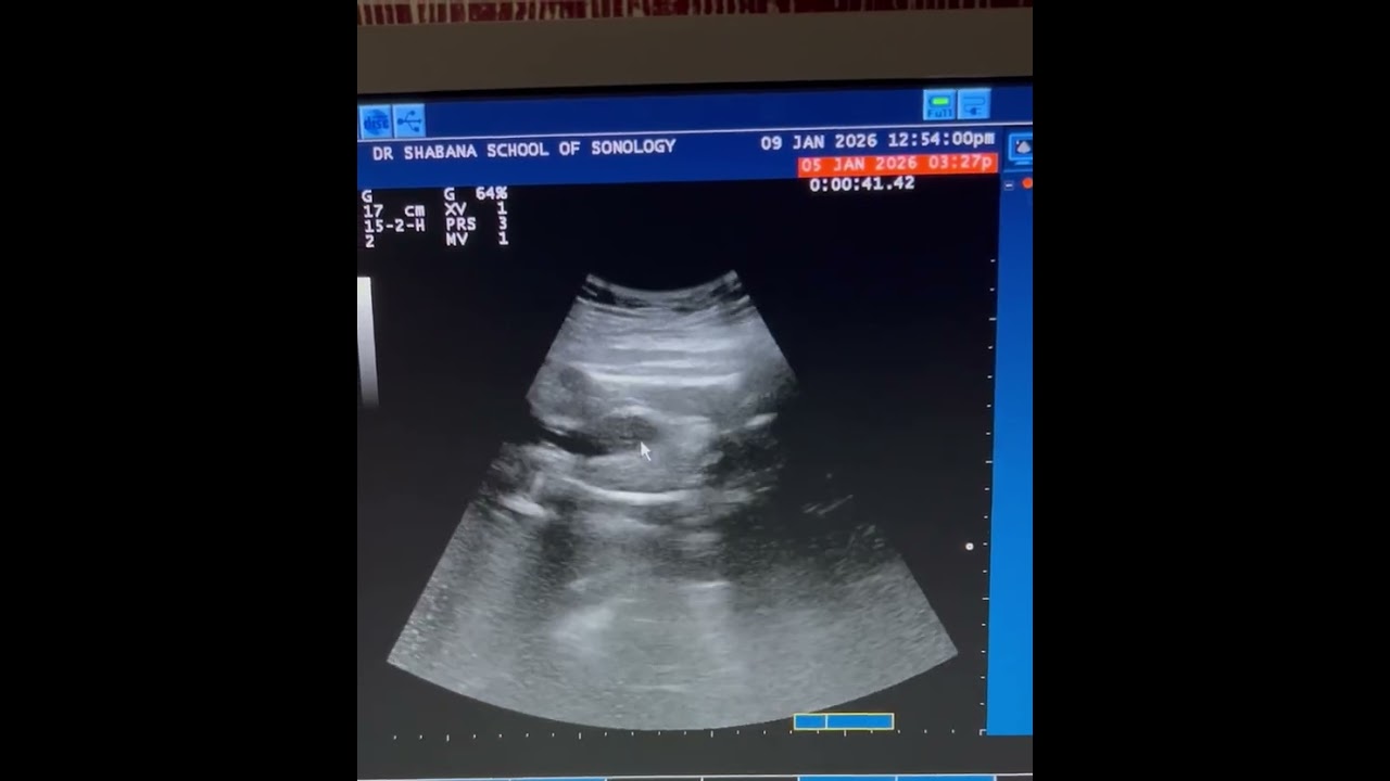 FWB scan