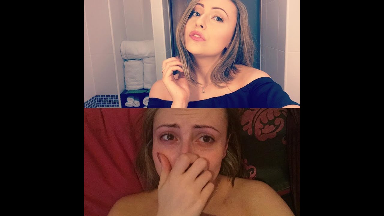 Amber Smith Shares Before and After Photos to Show Reality of Her Panic Attacks