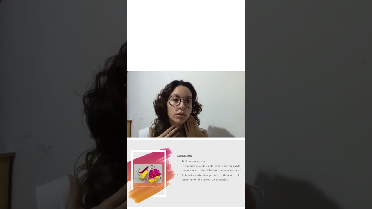 Aparatologia de Simoes Network 2/3