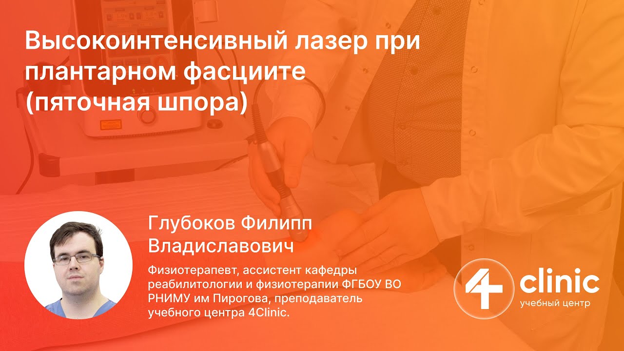 Высокоинтенсивный лазер 4Clinic при плантарном фасциите (пяточная шпора)