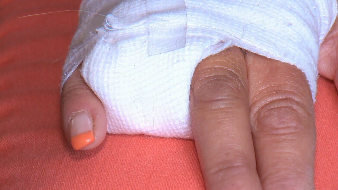 Woman loses finger in waterslide accident at West Edmonton Mall