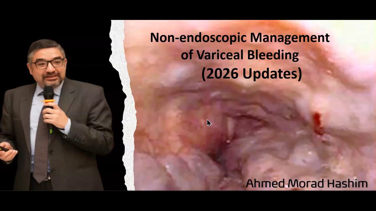 Updates in Bleeding Esophageal Varices management