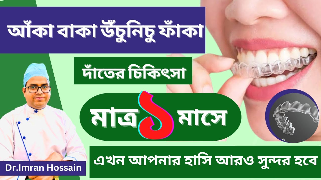 আঁকা বাকা দাঁতের আধুনিক চিকিৎসা | Invisalign | Aligner | Invisalign Cost
