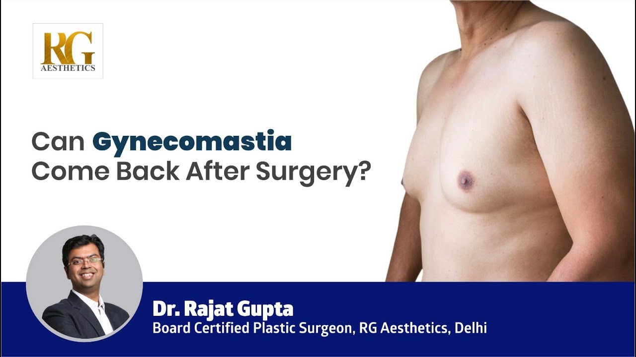 Can Gynecomastia Come Back After Surgery? Man Boobs Surgery | Dr Rajat Gupta - RG Aesthetics, Delhi