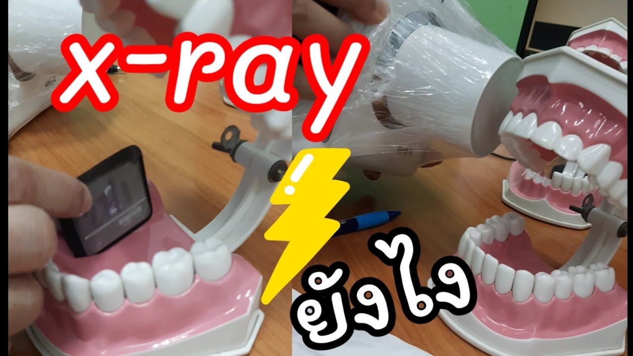 วิธีx-rayซี่ฟันแต่ละซี่พร้อมเทคนิค