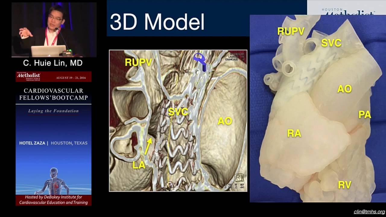 Adult Congenital 101 (C. Huie Lin, MD, PhD) Saturday, August 20, 2016