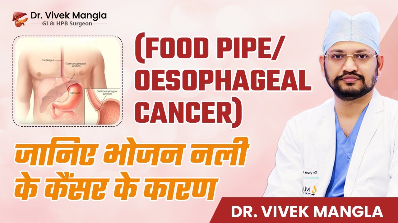 (Food Pipe Cancer) भोजन नली का कैंसर और उसके कारण  | Risk Factors & Causes of 