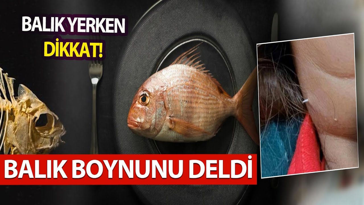 Yediği Balık Az Daha Sonu Oluyordu | Balık Yerken Nelere Dikkat Etmeliyiz?