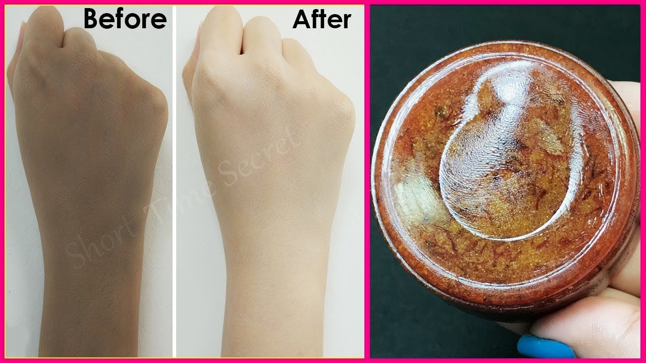 Magical Homemade Skin Whitening Soap | Removes Suntan, Dark spots, Acne-Pimples